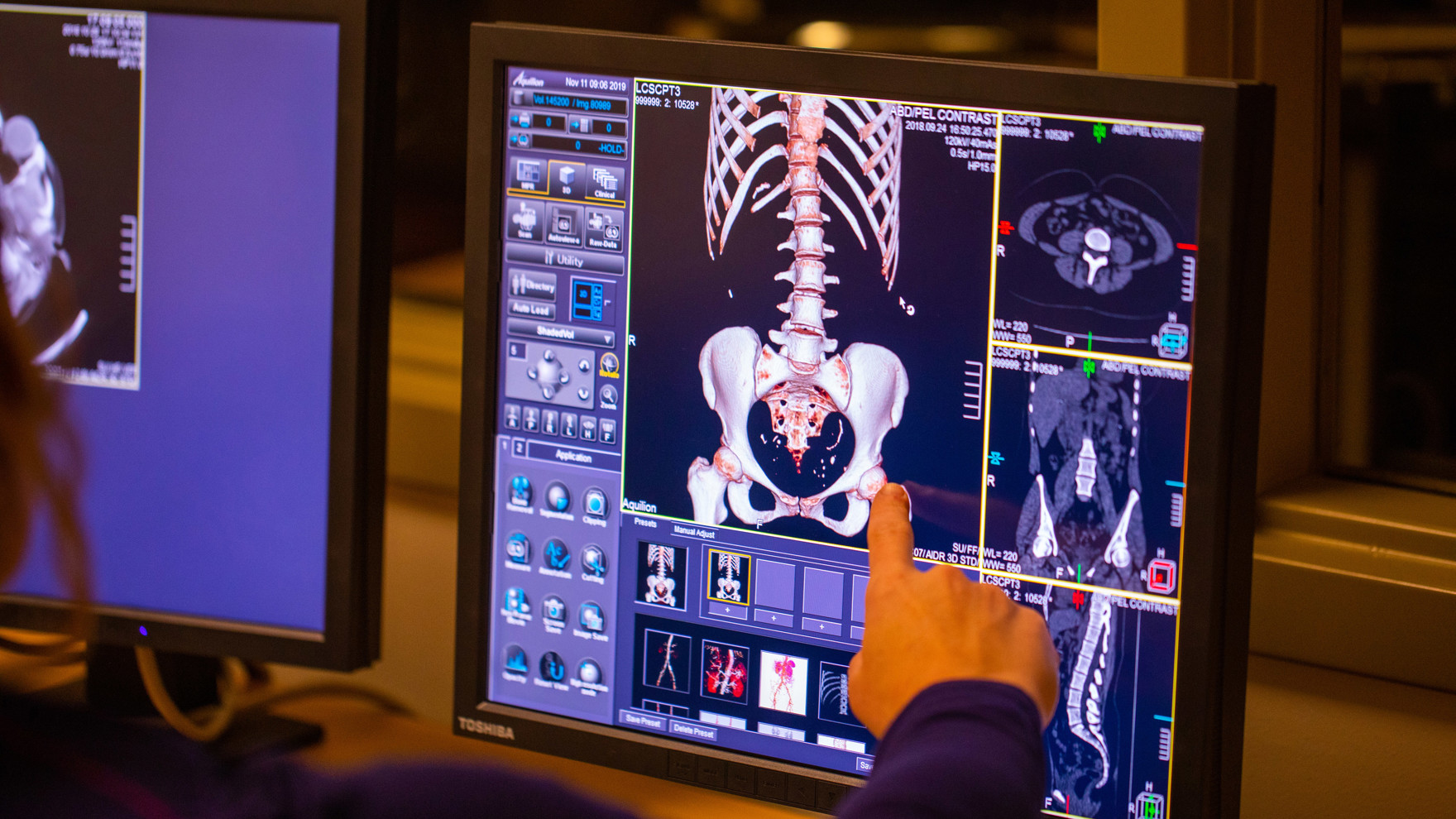 Radiographic Science - Degree Finder | Lewis-Clark State